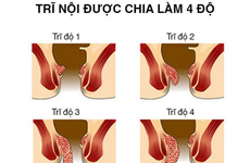 Các cấp độ bệnh trĩ và cách nhận biết