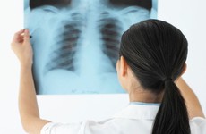Chẩn đoán bệnh đau lưng bằng phương pháp chụp X- quang