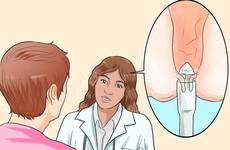 Tìm hiểu quy trình cắt trĩ cho bệnh nhân trĩ ngoại