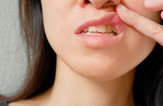 Cơn đau miệng trong ung thư đầu cổ có nguồn gốc từ đâu?