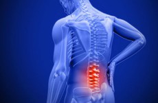 Thoái hóa cột sống thắt lưng có thể gây ra biến chứng nào?