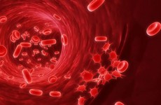 Những bệnh lý nào có khả năng làm tăng nguy cơ bị ung thư máu?