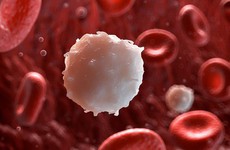 Ung thư máu và nhiễm trùng huyết khác nhau như thế nào?