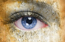 Bệnh khô mắt là gì? Tổng quan về bệnh khô mắt