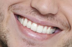 Chăm sóc răng miệng cho nam giới đúng cách