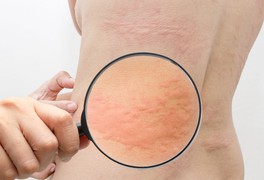 [Infographics] - 8 bộ phận cơ thể bị "bào mòn" như thế nào bởi thức ăn nhanh?