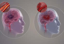 [Infographics] - 8 bộ phận cơ thể bị "bào mòn" như thế nào bởi thức ăn nhanh?
