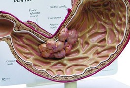 [Infographics] - 8 bộ phận cơ thể bị "bào mòn" như thế nào bởi thức ăn nhanh?