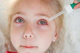 Chăm sóc trẻ bị đau mắt đỏ như thế nào mới đúng cách?