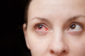 Những kiến thức cần biết về thuốc điều trị đau mắt đỏ ở phụ nữ mang thai?