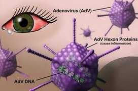 Bệnh viêm kết mạc do virus (đau mắt đỏ do virus) là gì? Đau mắt đỏ do virus có uống thuốc kháng sinh được không?