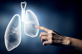 4 nguyên nhân gây ung thư phổi từ những thói quen thường ngày