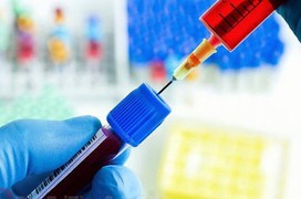 Những chỉ số trong xét nghiệm viêm gan B