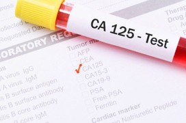 CA 125: Chỉ dấu quan trọng trong tầm soát ung thư buồng trứng