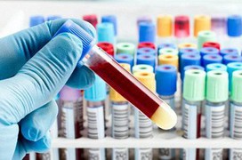 Tìm hiểu về phương pháp xét nghiệm Clo máu
