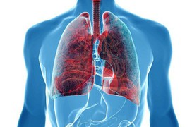 Tìm hiểu về 8 loại ung thư phổi theo phân loại của WHO