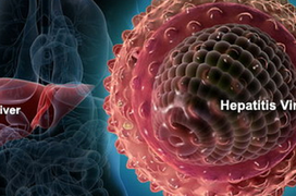 Viêm gan B có thể biến chứng thành xơ gan và ung thư gan: Tỷ lệ nhiễm và quá trình tiến triển