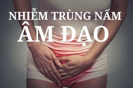 Tổng quan kiến thức về bệnh nấm âm đạo