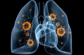 Cảnh báo: 4 nhóm người có nguy cơ mắc ung thư phổi!