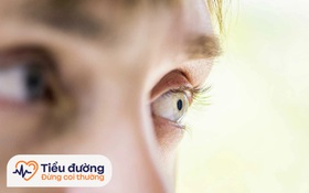 Bệnh võng mạc tiểu đường là gì? Nguy hiểm như thế nào?