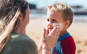Chăm sóc da cho trẻ mùa hè, phụ huynh cần lưu ý điều gì?