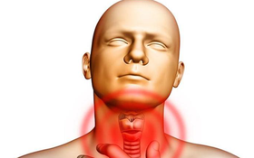 Bệnh nhân cường giáp sống được bao lâu? Cách điều trị bệnh thế nào?