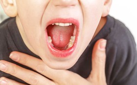 4 sai lầm làm trẻ mắc bệnh tai mũi họng khi giao mùa