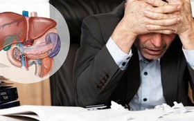 Bệnh ung thư gan sống được bao lâu và các giai đoạn chính