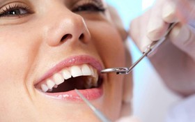 Lấy vôi răng có tốt không và những điều cần biết về lấy vôi răng