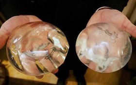 Cách để vượt qua nỗi ám ảnh thay đổi cơ thể sau điều trị ung thư vú