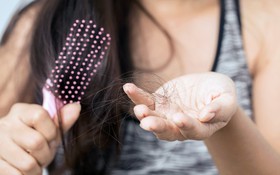 Xử trí nhanh hiện tượng rụng tóc khi điều trị ung thư vú