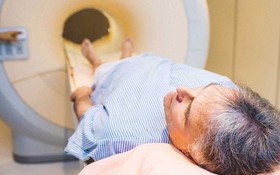 Tiên lượng sống cho bệnh ung thư vòm họng theo từng giai đoạn