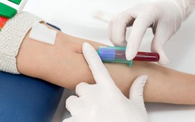 Xét nghiệm máu có giúp chẩn đoán sốt xuất huyết không?