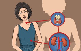 Mối liên quan giữa bệnh tuyến giáp và khả năng sinh sản ở nữ giới