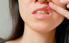 Cơn đau miệng trong ung thư đầu cổ có nguồn gốc từ đâu?