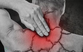 Thuốc điều trị đau mỏi vai gáy có thể gây ra những tác dụng phụ nào?