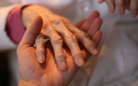 4 lưu ý cần nhớ về phẫu thuật chữa viêm khớp dạng thấp