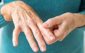Tổng quan về bệnh viêm khớp