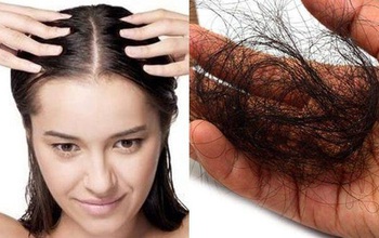 Rụng tóc: Nguyên nhân và cách ngăn ngừa rụng tóc