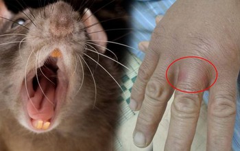 Bị chuột hamster cắn có sao không? Cách xử lý vết thương khi bị chuột hamster cắn