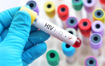 HIV có lây qua nước bọt không? HIV lây nhiễm qua con đường nào?