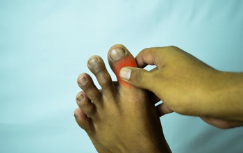 Đau nhói ở ngón chân cái như bị kim châm là bệnh gì?