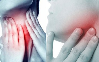 Ung thư vòm họng giai đoạn 2: Dấu hiệu, cách điều trị và tiên lượng sống