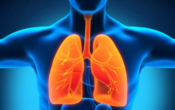 Bệnh viêm phổi: Dấu hiệu, nguyên nhân, cách điều trị và phòng tránh