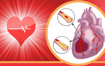 Nhồi máu cơ tim là gì? Chớ coi thường 10 dấu hiệu sau đây của nhồi máu cơ tim