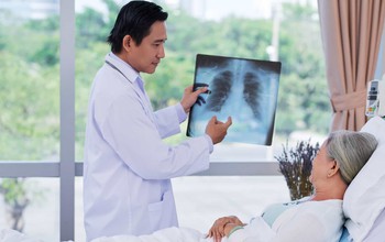 Ung thư phổi sống được bao lâu và hướng dẫn cách kéo dài thời gian sống cho người bệnh