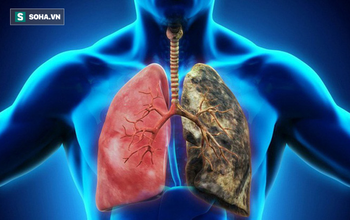 7 thói quen tốt cho phổi bạn nên làm hàng ngày