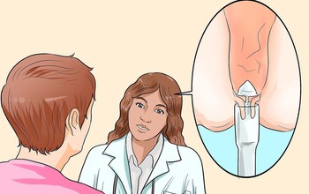 Tìm hiểu quy trình cắt trĩ cho bệnh nhân trĩ ngoại