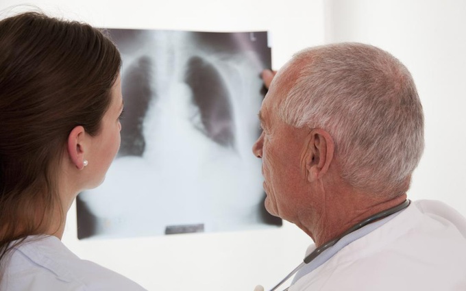 Chụp X quang có thể phát hiện bệnh phổi tắc nghẽn mãn tính không?