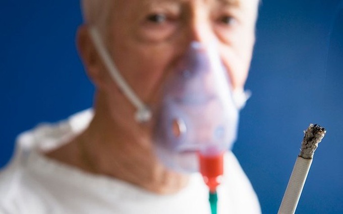 Bệnh phổi tắc nghẽn mãn tính COPD có lây không? COPD có phải bệnh truyền nhiễm không?